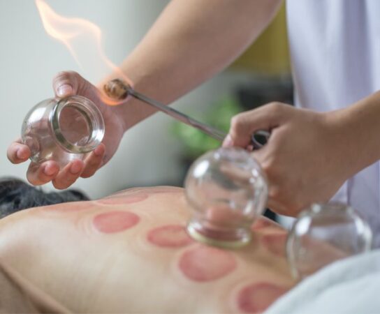 Découverte de l&rsquo;acupuncture : histoire, techniques et applications modernes