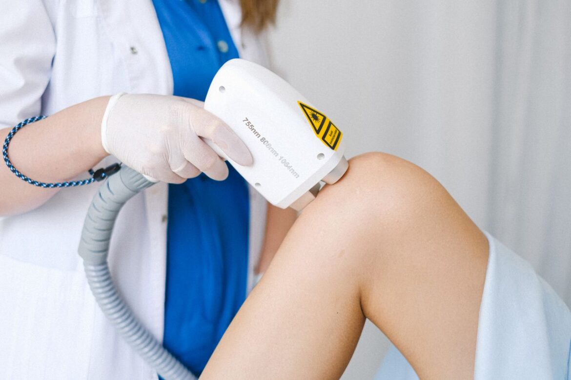 Hormones et épilation définitive : pourquoi ça peut rater?